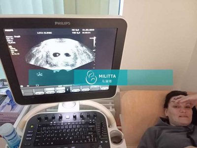 两位乌克兰试管妈妈来医院做孕6周B超，确认宫内着床宝宝