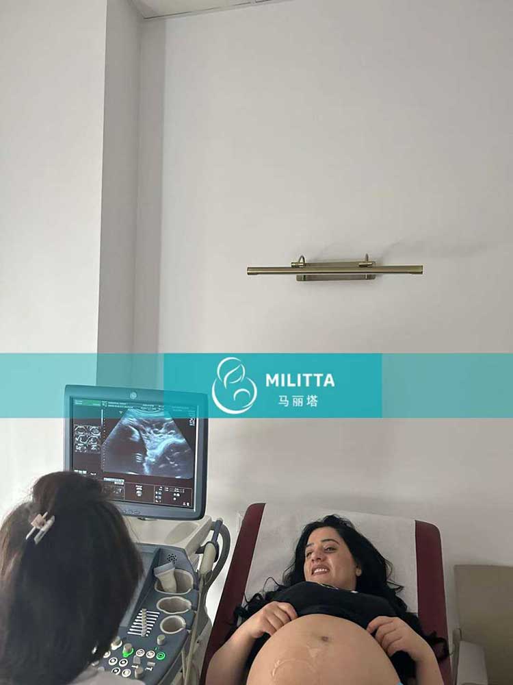 试管妈妈做B超