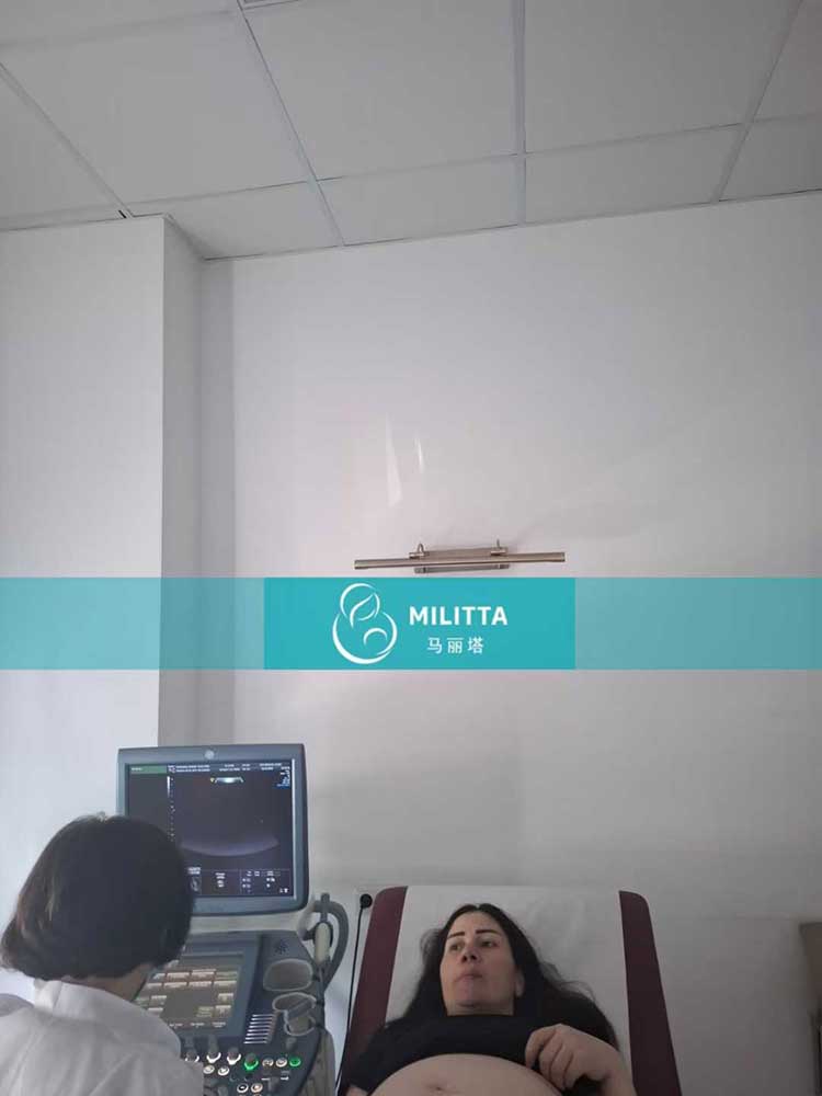 试管妈妈做B超
