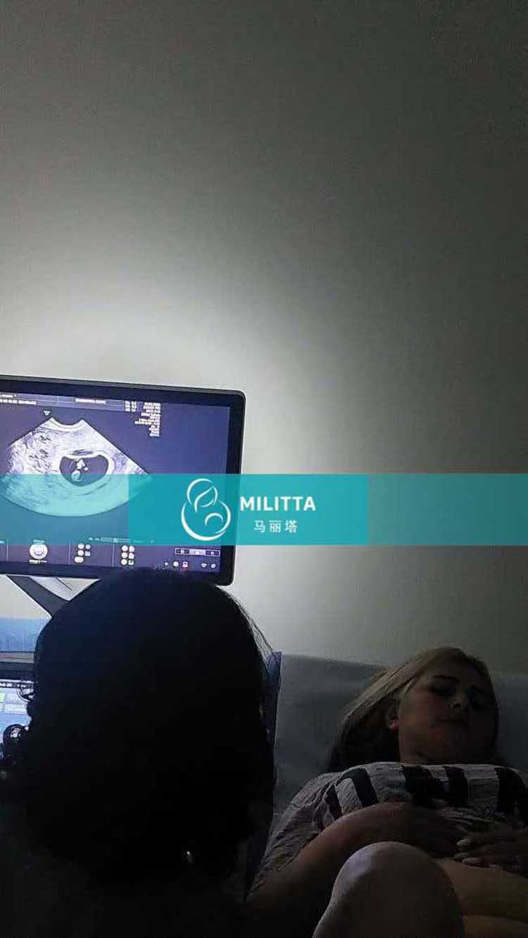 试管妈妈做产检