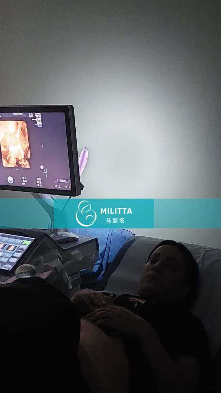 试管妈妈做产检