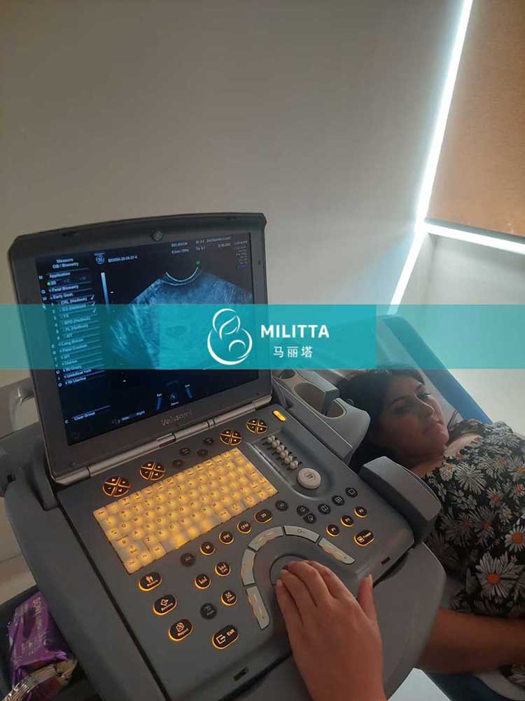 试管妈妈孕早期B超