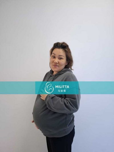 四位在格鲁吉亚的试管妈妈做孕晚期不同孕周B超