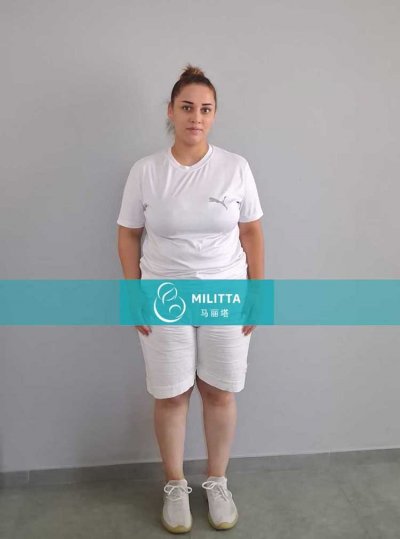 一位格鲁吉亚的试管妈妈来医院做孕12周B超