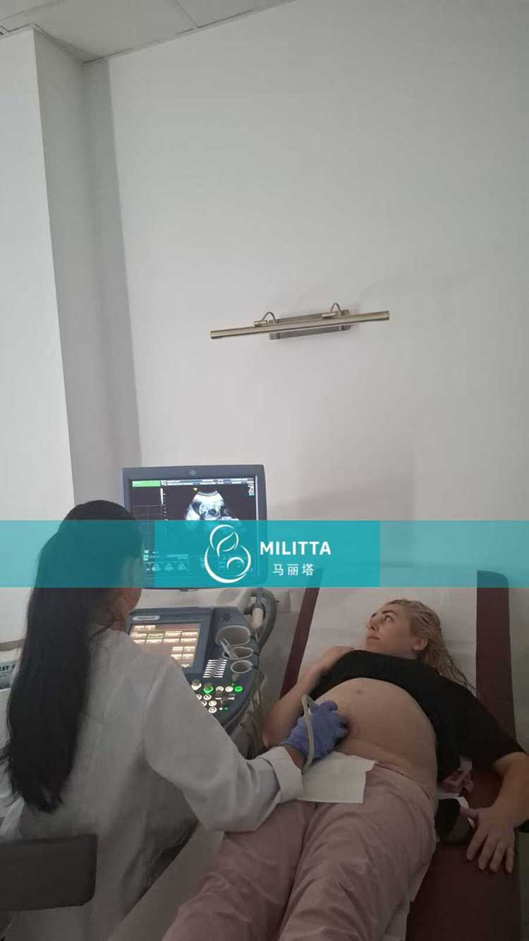 试管妈妈做四维彩超