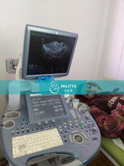 三位已经通过审核的试管妈妈来格鲁吉亚医院调理内膜