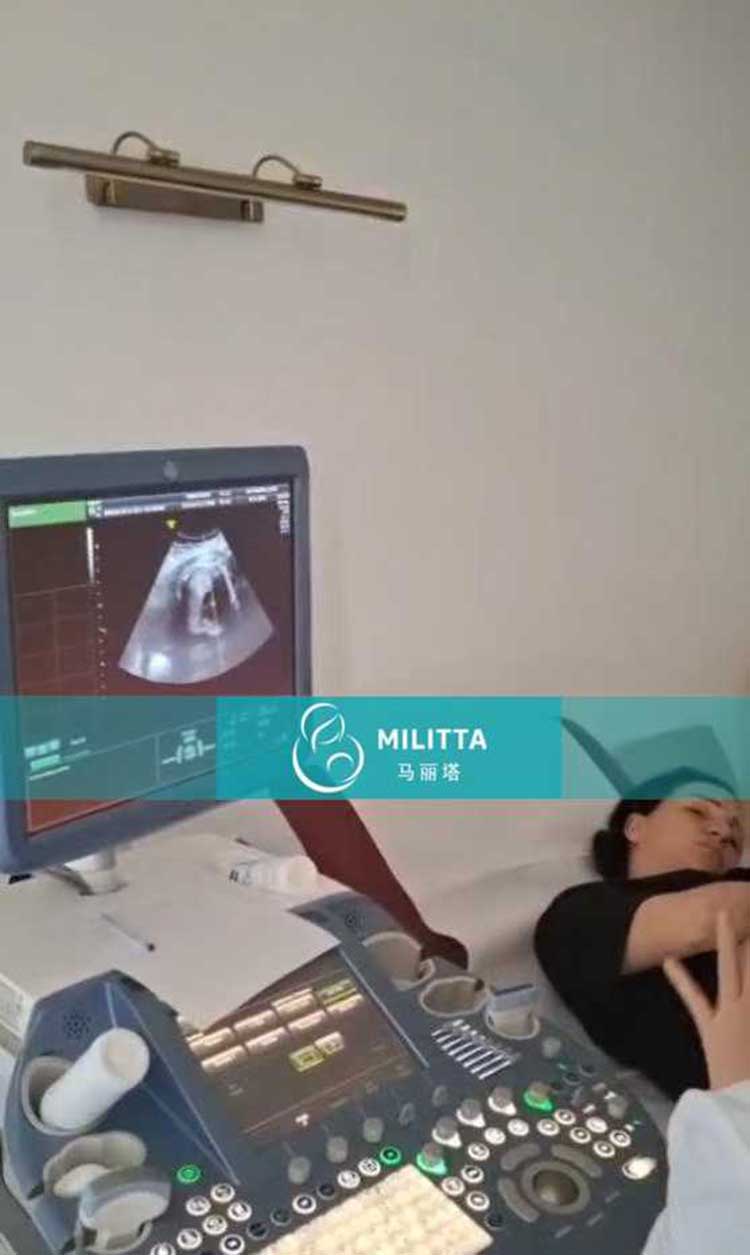试管妈妈做B超