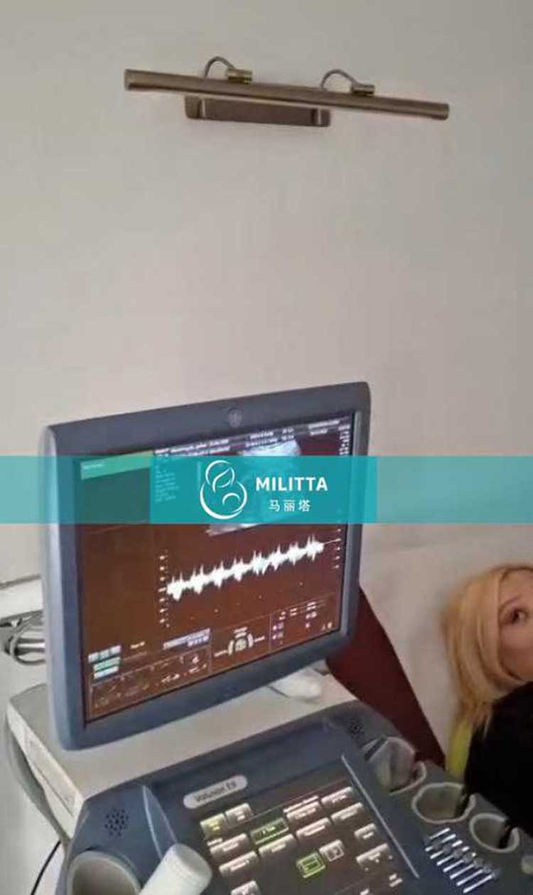 试管妈妈做产检