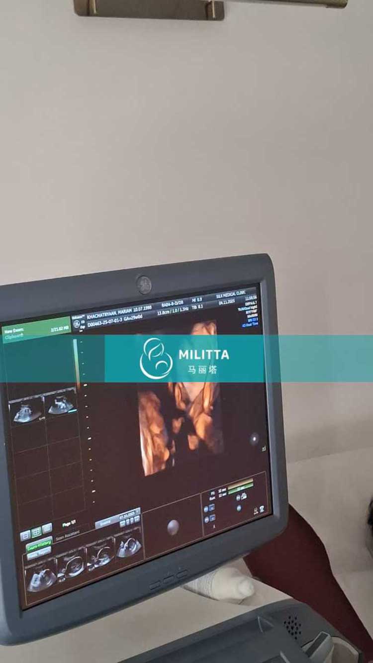 试管妈妈做产检