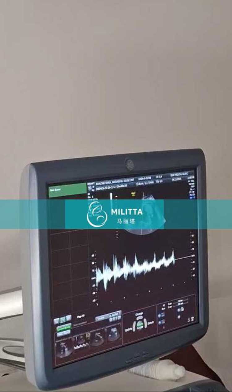 试管妈妈做产检