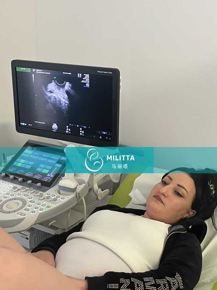 试管妈妈做B超