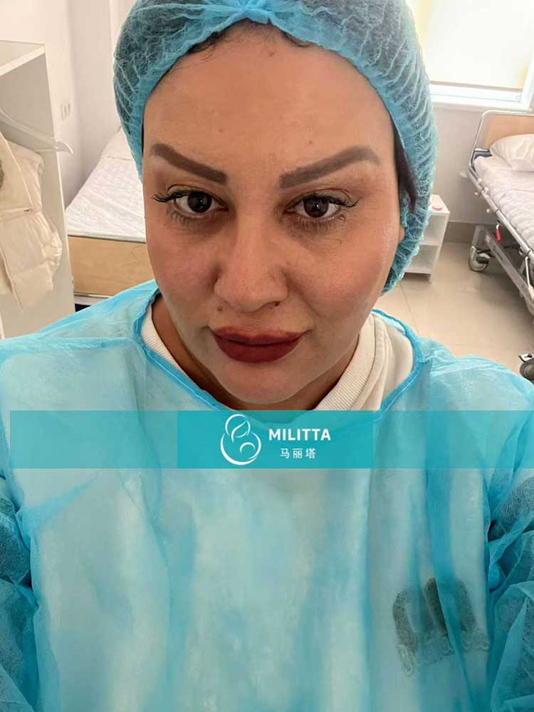 试管妈妈移植胚胎