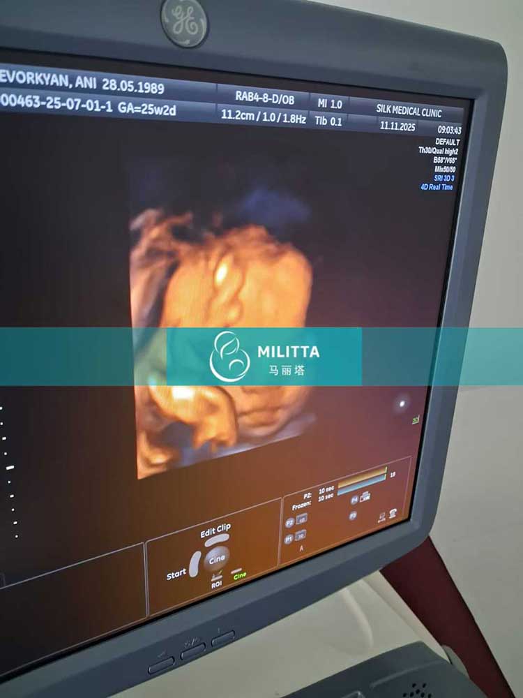 试管妈妈做孕检