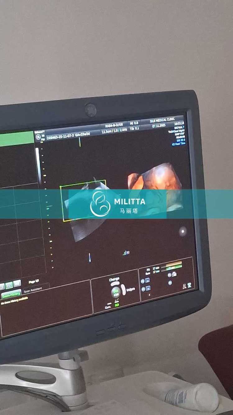 试管妈妈做孕检