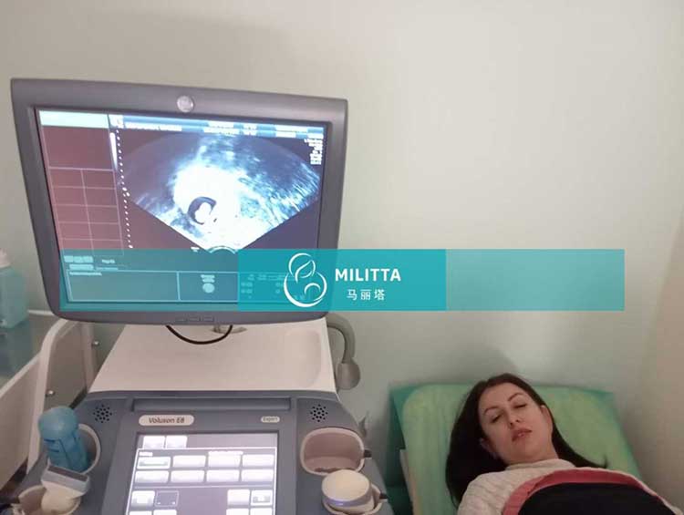 试管妈妈做B超