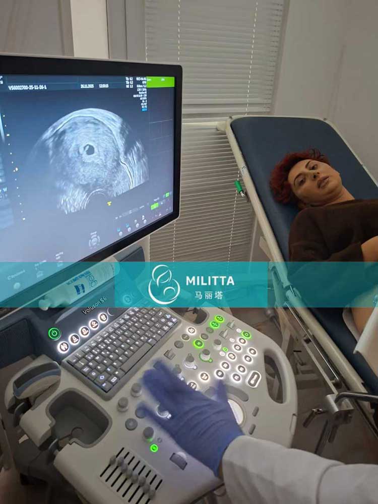 试管妈妈做首次B超