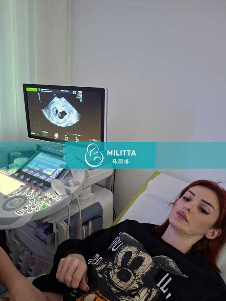 试管妈妈做B超