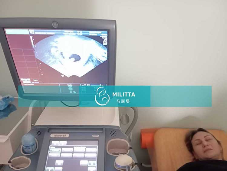 乌克兰试管妈妈做B超