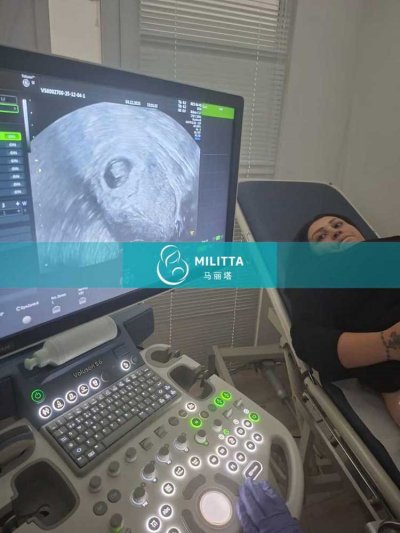 两位孕早期试管妈妈在格鲁吉亚医院分别做孕5周+,孕7周+B超