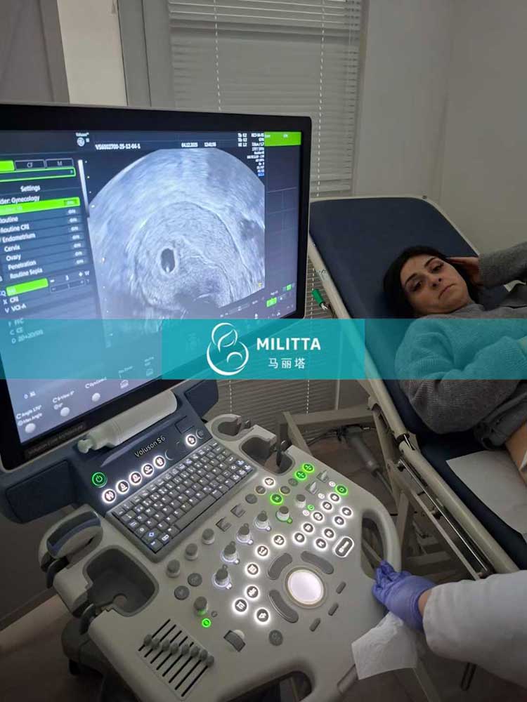 试管妈妈做B超