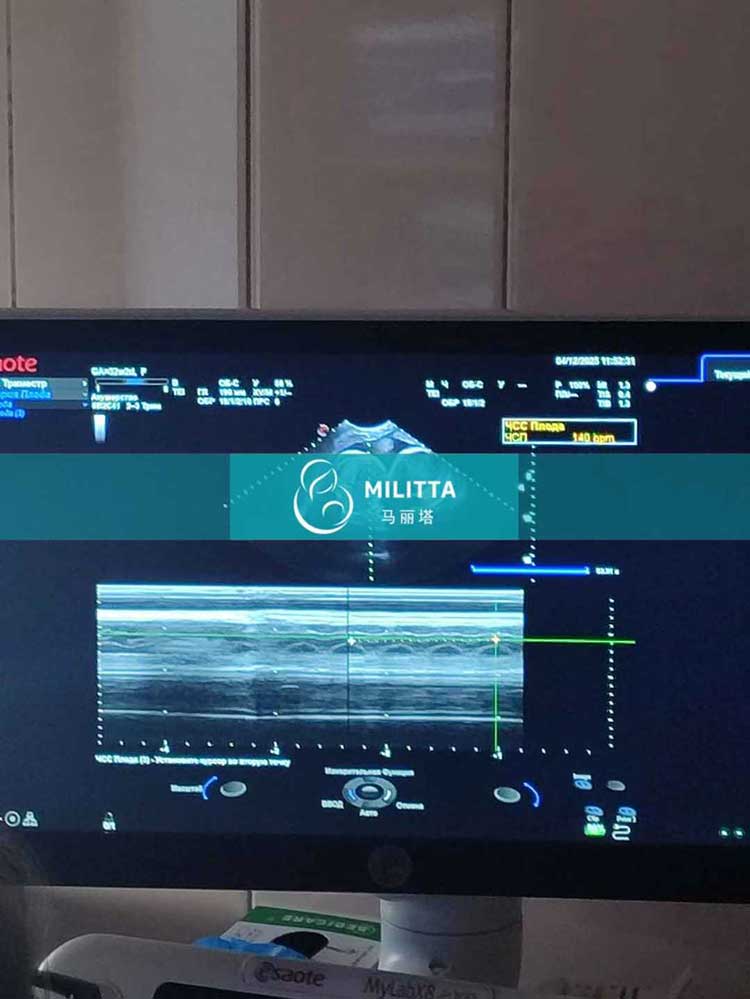 试管妈妈做产检