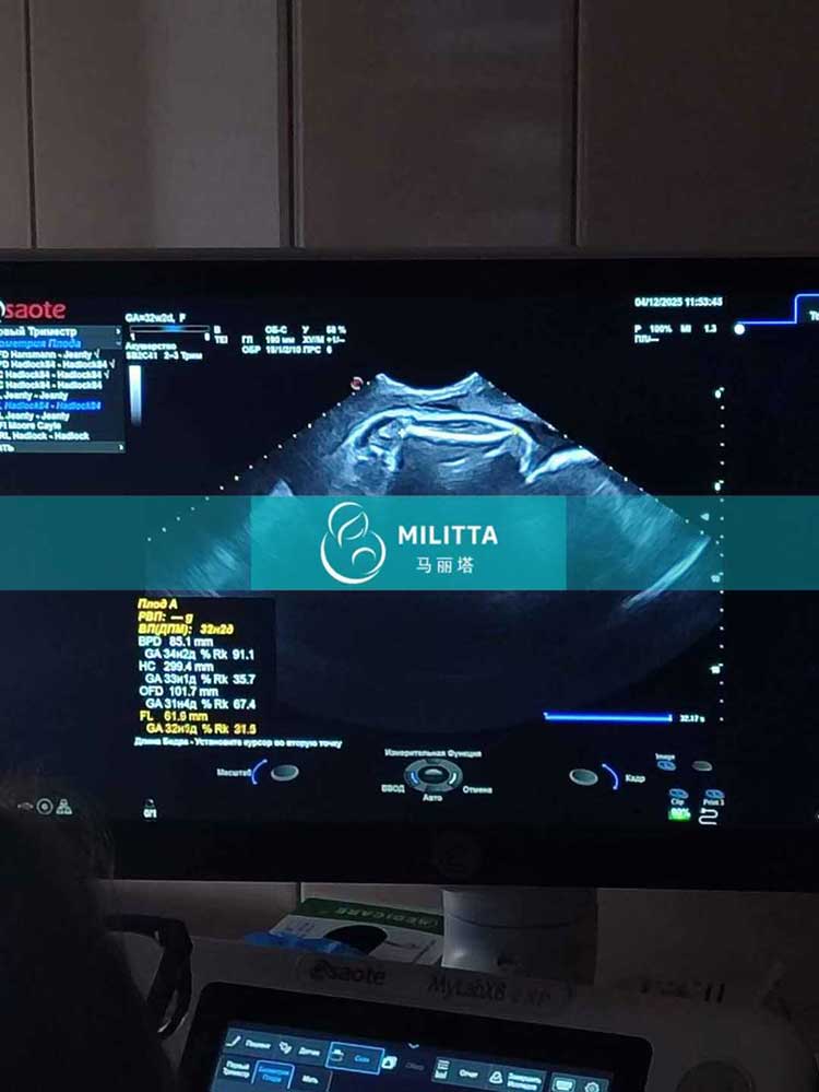 试管妈妈做产检