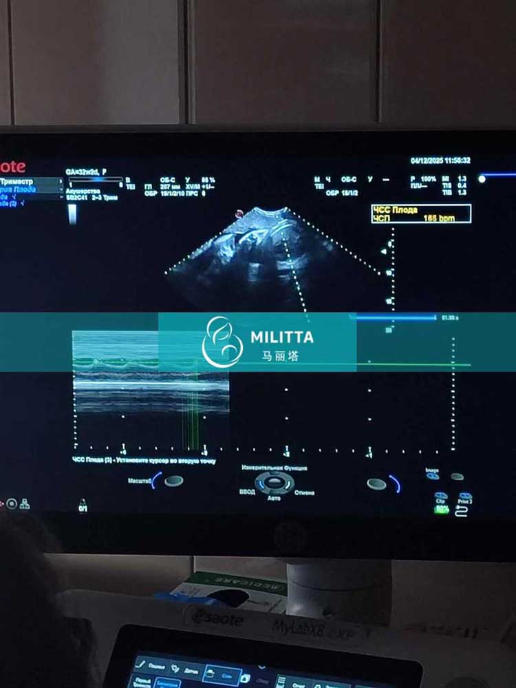 试管妈妈做产检