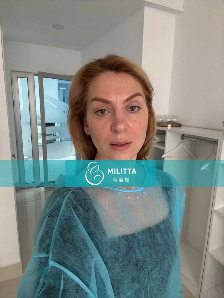 试管妈妈移植胚胎