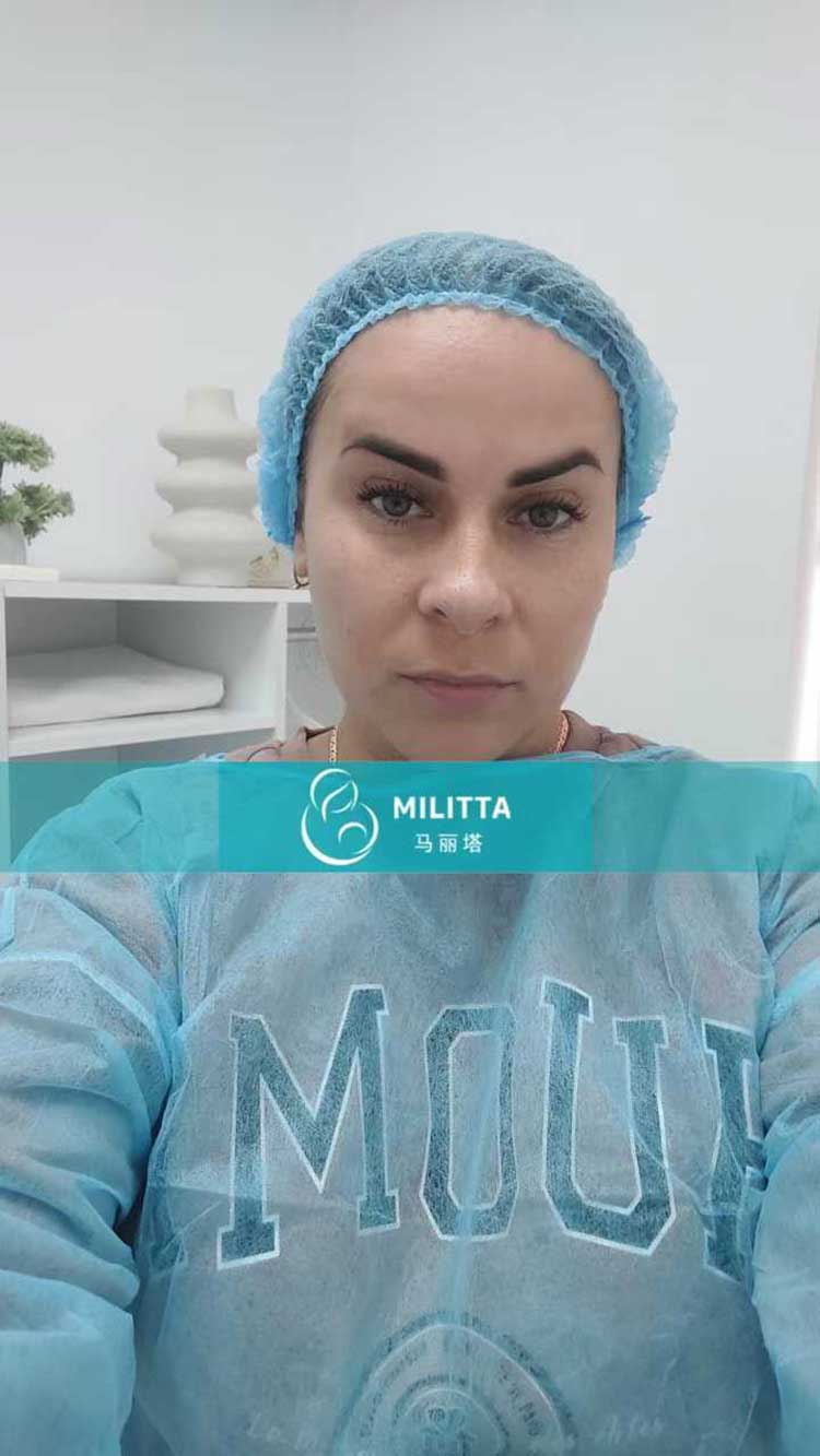 试管妈妈移植胚胎