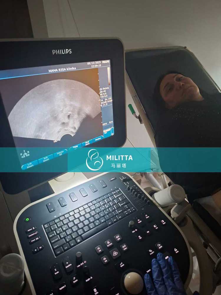 试管妈妈移植胚胎