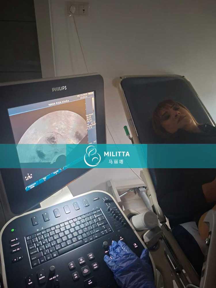 试管妈妈移植胚胎