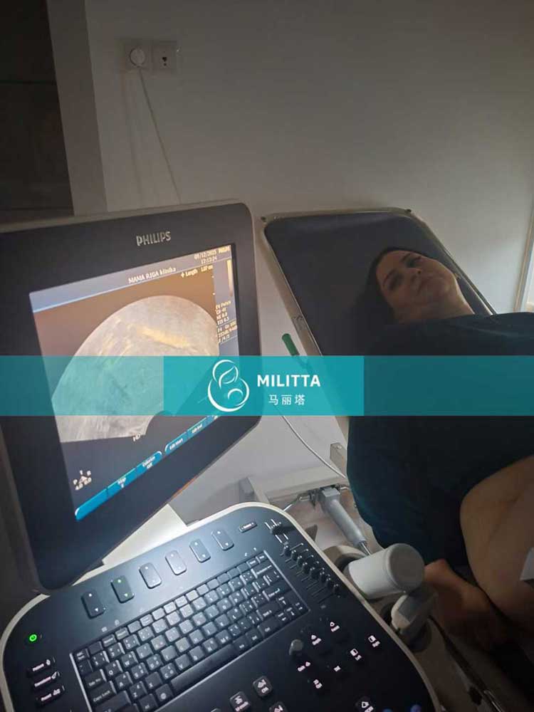 试管妈妈移植胚胎