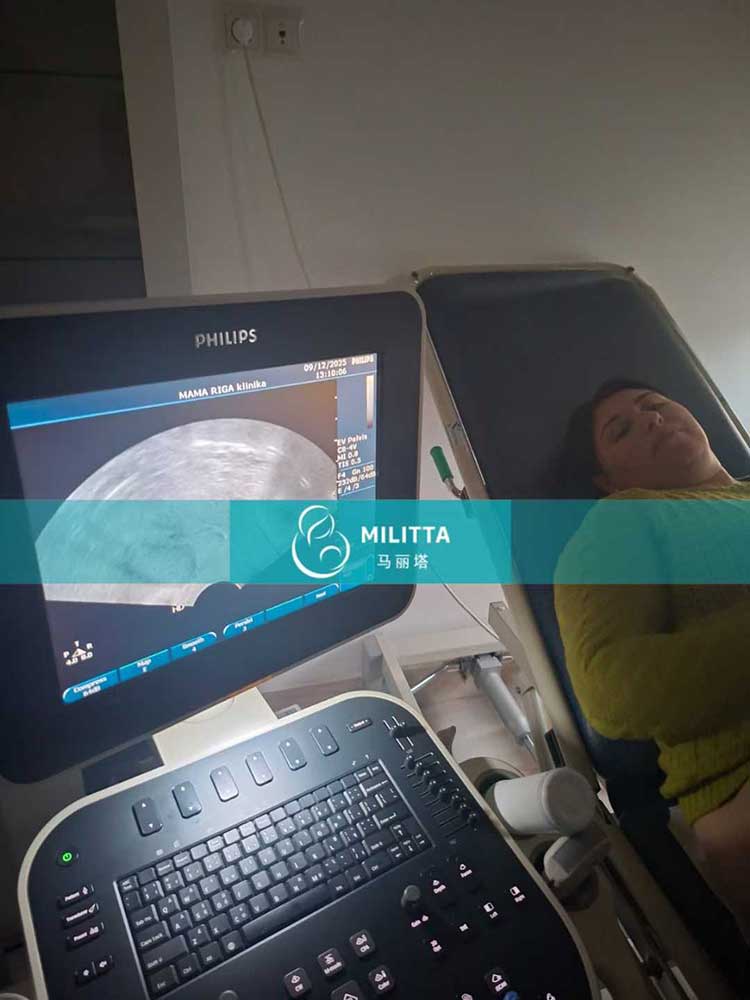 试管妈妈移植胚胎