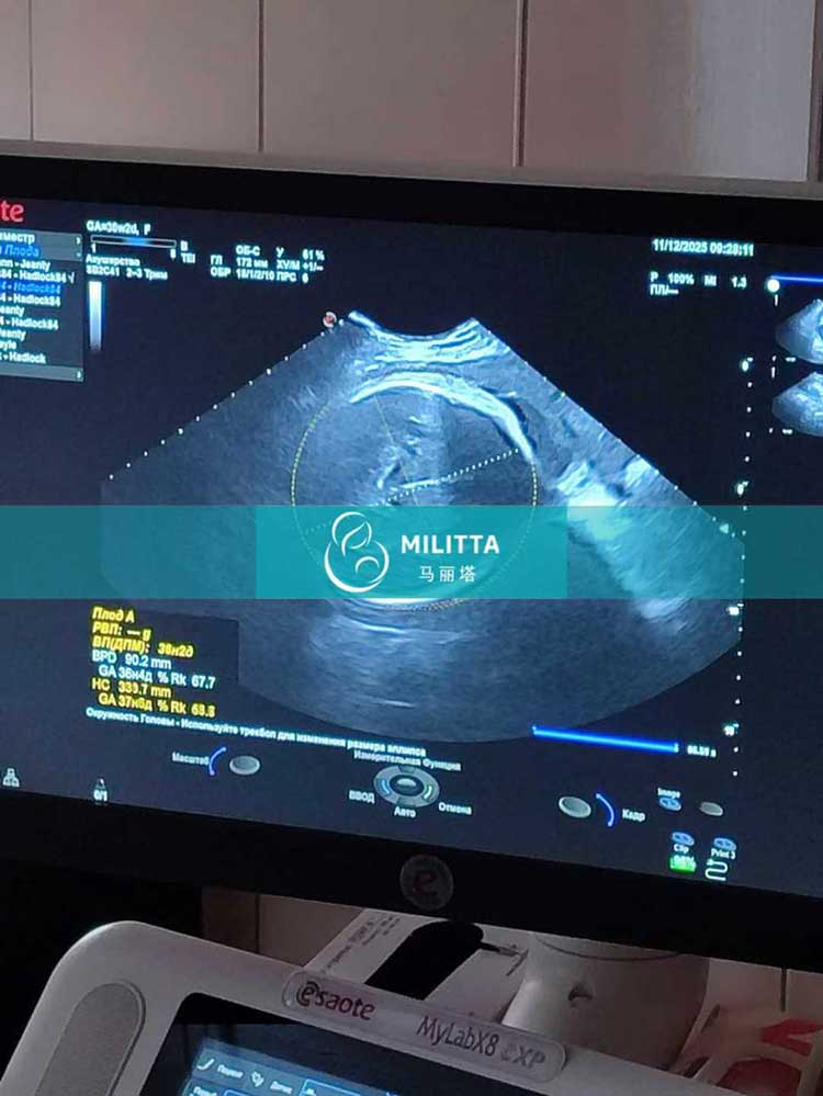 试管妈妈做产检