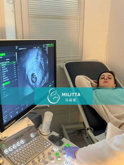 张先生在格鲁吉亚匹配的试管妈妈孕8周B超胎心搏动清晰有力