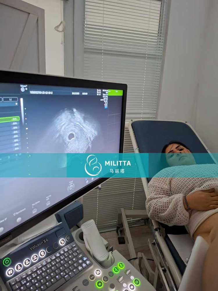 试管妈妈做产检