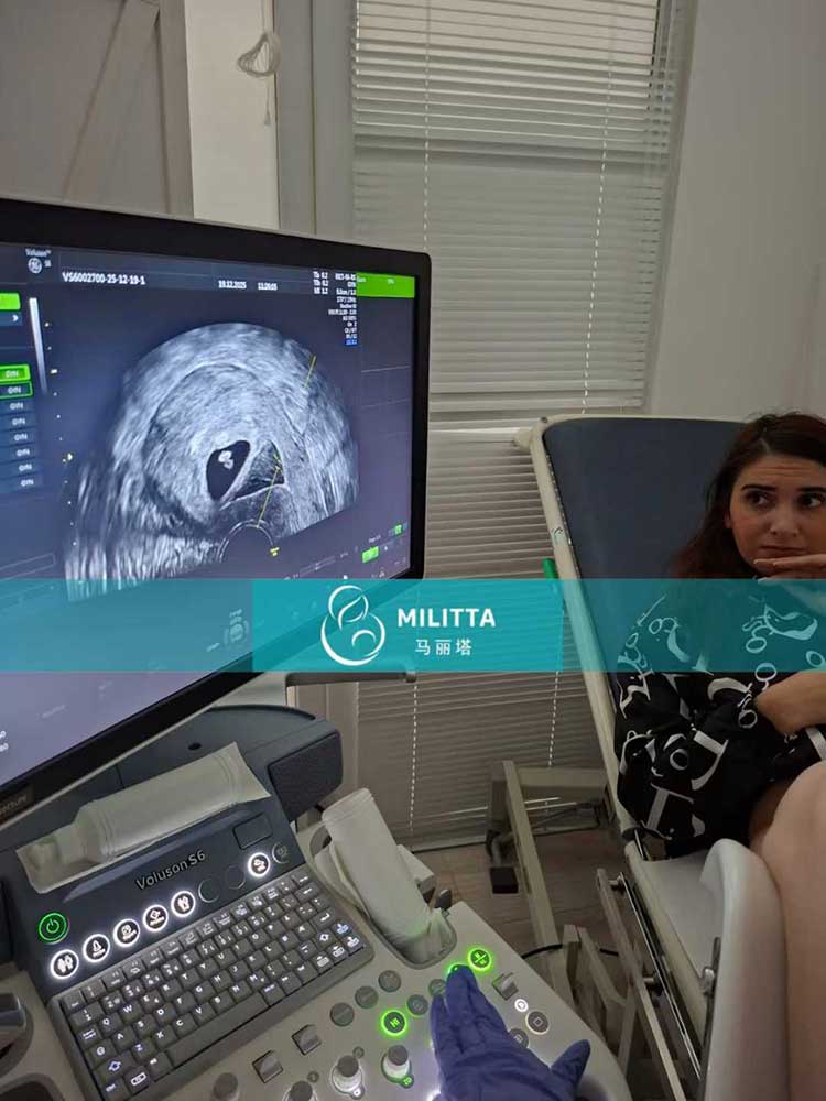 试管妈妈做产检