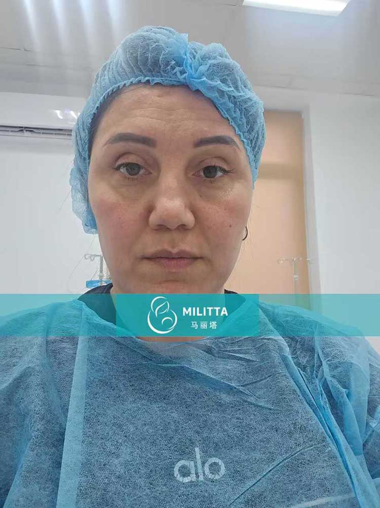 试管妈妈移植胚胎