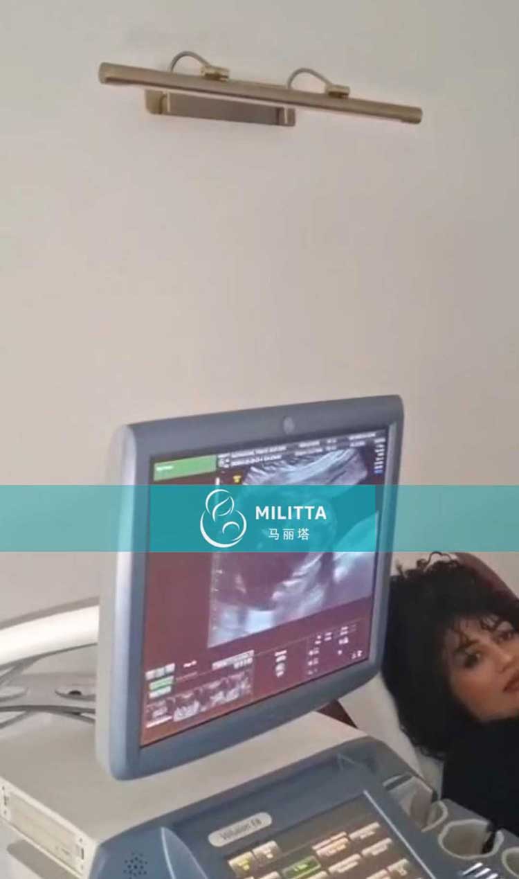 试管妈妈做B超