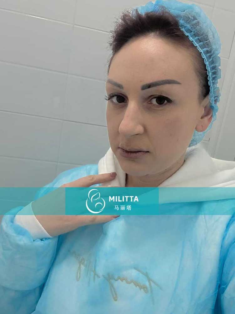 试管妈妈移植胚胎