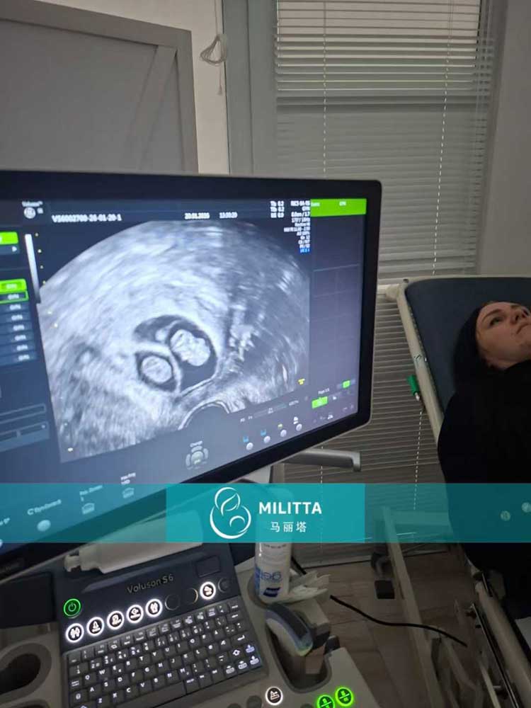 试管妈妈做产检