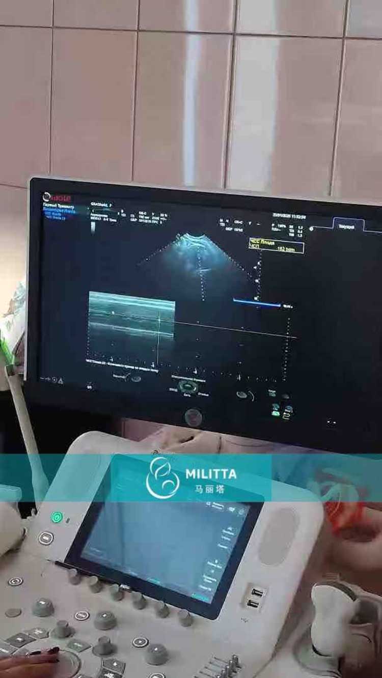 试管妈妈做产检