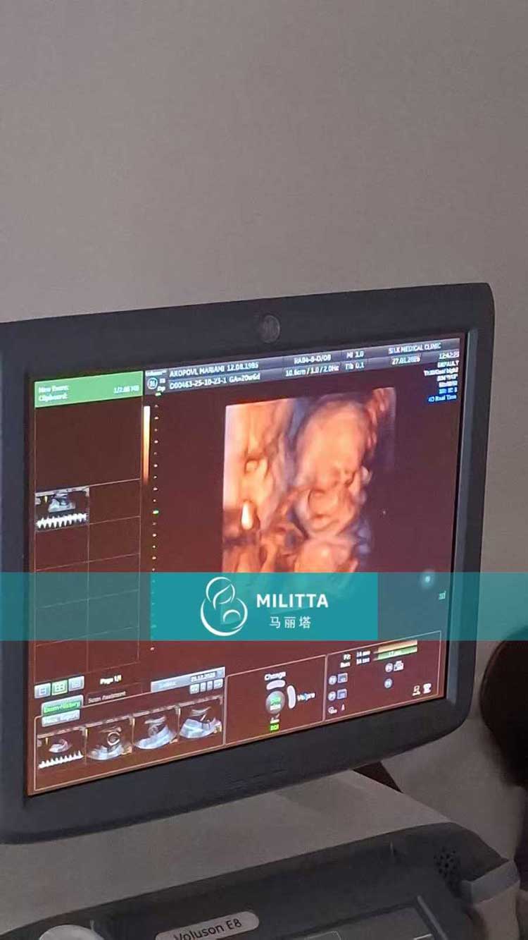 试管妈妈做产检