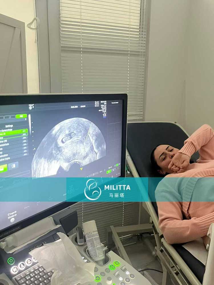 试管妈妈做产检