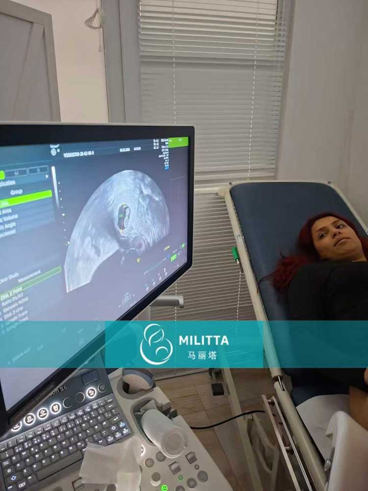 试管妈妈做产检