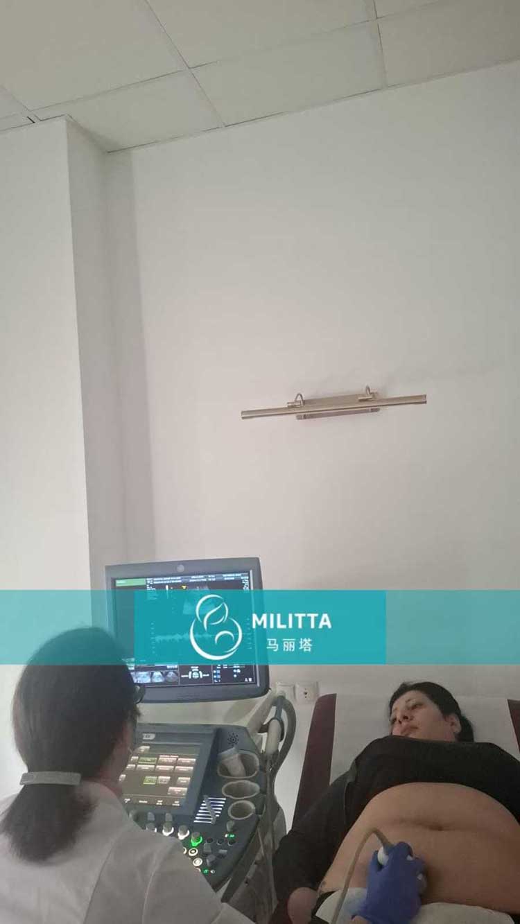 试管妈妈做产检