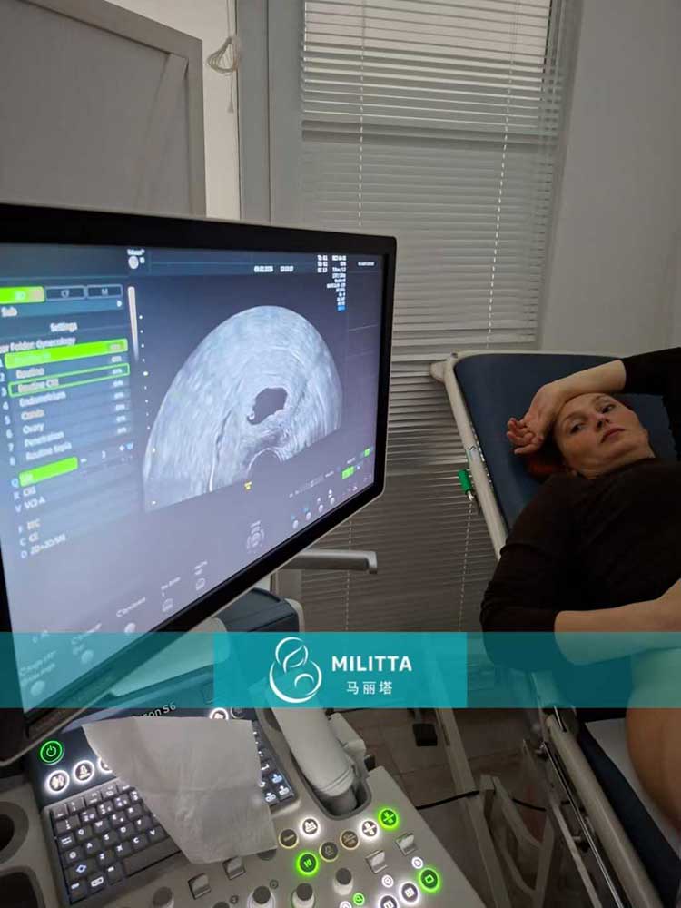 试管妈妈做产检