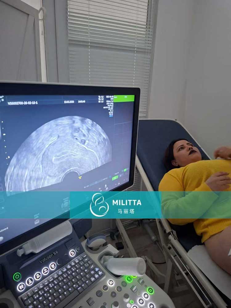 试管妈妈做产检