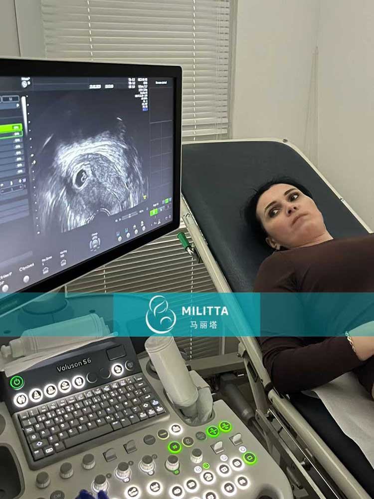 试管妈妈做产检