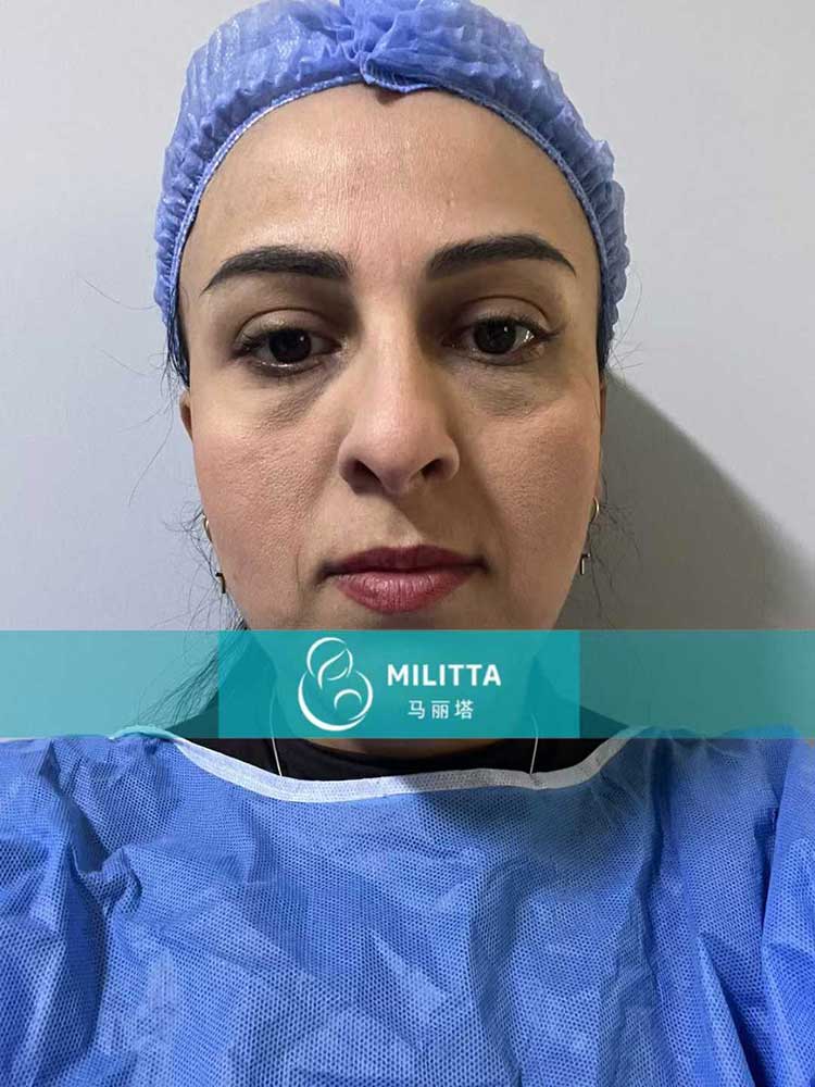 试管妈妈移植胚胎